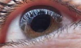 Un hombre que era ciego volvi� a ver tras un autotrasplante de ojo en Italia