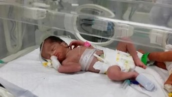 Practicaron una cesárea a una mujer muerta en un ataque israelí y salvaron a su bebé